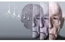 Alzheimer Çeşitleri ve Evreleri