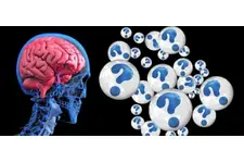 Alzheimer Başlangıcı Belirtileri ve Tedavisi