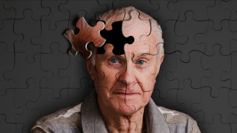 Alzheimer Kaç Yaşında Başlar